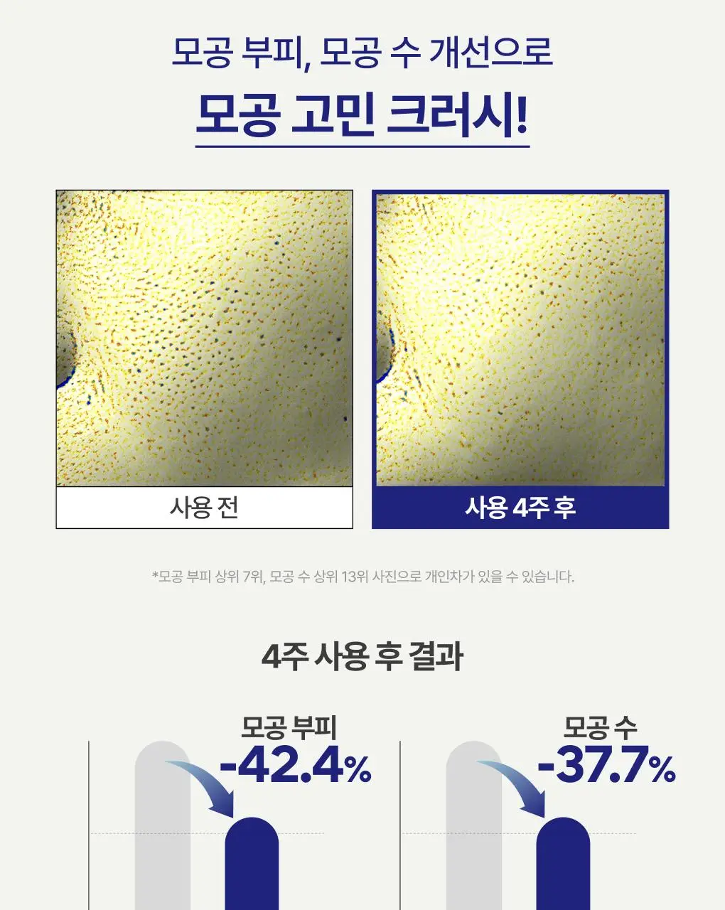 [1+1] 이니스프리 레티놀 시카 모공 흔적 앰플 30ml 리필기획(+30ml 리필) 상세페이지 28